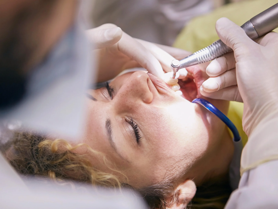Dental Checkups