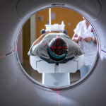 Conventional Radiation vs. Proton Remedy